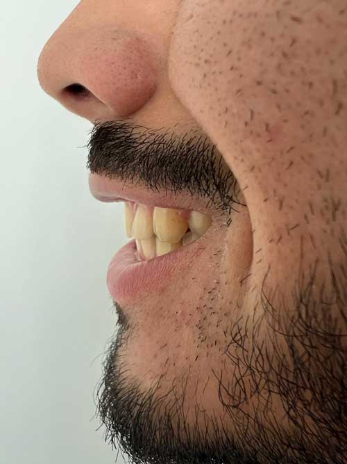 example Open wide and look down